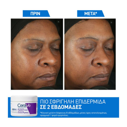Skin Renewing Peptide &Kappa;&rho;έ&mu;&alpha; &Pi;&rho;&omicron;&sigma;ώ&pi;&omicron;&upsilon; - &Nu;έ&alpha; &Pi;&rho;&omicron;ϊό&nu;&tau;&alpha; | L'Or&eacute;al Dermatological Beauty Partner Shop