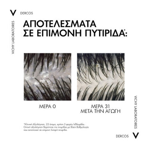 DERCOS Anti-Dandruff DS &Sigma;&alpha;&mu;&pi;&omicron;&upsilon;ά&nu; &gamma;&iota;&alpha; &kappa;&alpha;&nu;&omicron;&nu;&iota;&kappa;ά - &lambda;&iota;&pi;&alpha;&rho;ά. Refill 390ml - Eco-&pi;&rho;&omicron;ϊό&nu;&tau;&alpha; 🍃 | L'Or&eacute;al Dermatological Beauty Partner Shop