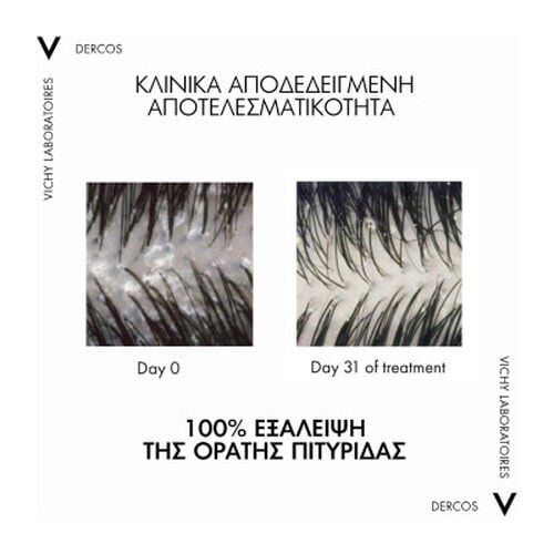 DERCOS Anti-Dandruff DS 2&sigma;&epsilon;1 &Sigma;&alpha;&mu;&pi;&omicron;&upsilon;ά&nu; & Conditioner 390 ml - Dercos | LDBPartnerShop