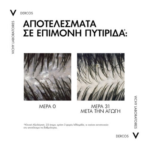 DERCOS Anti-Dandruff DS &Sigma;&alpha;&mu;&pi;&omicron;&upsilon;ά&nu; &gamma;&iota;&alpha; &xi;&eta;&rho;ά &mu;&alpha;&lambda;&lambda;&iota;ά. Refill 390ml - Eco-&pi;&rho;&omicron;ϊό&nu;&tau;&alpha; 🍃 | L'Or&eacute;al Dermatological Beauty Partner Shop